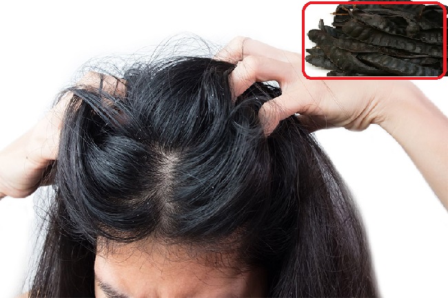Nguyên nhân và cách phòng ngừa bệnh nấm da đầu